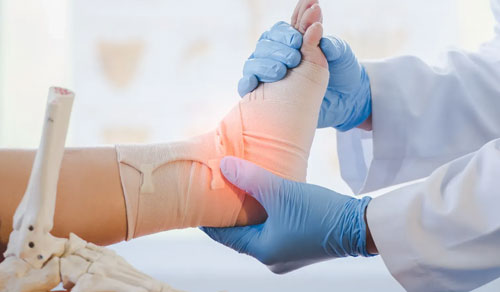 Fracture Care