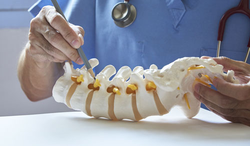 Spine Surgery