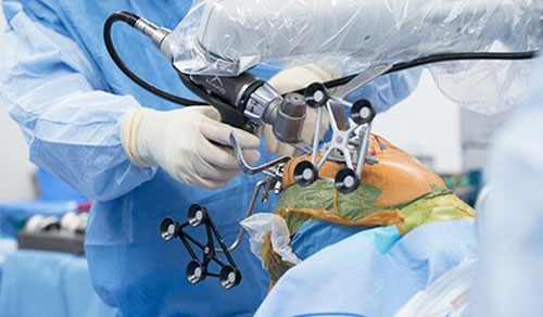 Robotic Knee Replacement Surgery